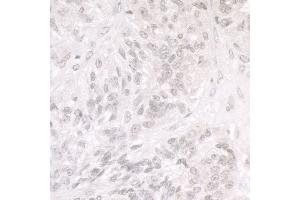 Immunohistochemistry (IHC) image for anti-SWI/SNF Related, Matrix Associated, Actin Dependent Regulator of Chromatin, Subfamily A, Member 1 (SMARCA1) (AA 1004-1054) antibody (ABIN7453459)
