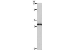Western Blotting (WB) image for anti-T-Box 5 (TBX5) antibody (ABIN2434990) (T-Box 5 anticorps)