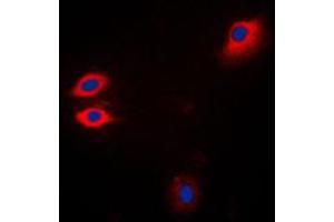 Immunofluorescent analysis of JAK1 staining in Jurkat cells. (JAK1 anticorps  (C-Term))