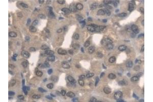 Detection of PNPO in Mouse Stomach Tissue using Polyclonal Antibody to Pyridoxamine-5'-Phosphate Oxidase (PNPO)