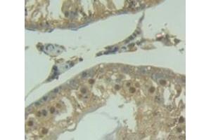 Figure. (AIM2 anticorps  (AA 1-343))