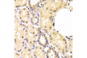 Immunohistochemistry of paraffin-embedded human kidney using SMAD1 antibody (ABIN5970455) at dilution of 1/100 (40x lens).