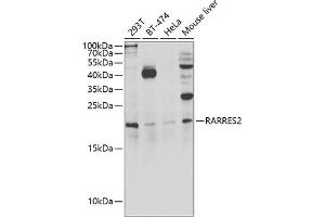Western blot analysis of extracts of various cell lines, using R antibody (ABIN6131585, ABIN6146704, ABIN6146705 and ABIN6222716) at 1:1000 dilution. (Chemerin anticorps  (AA 17-163))
