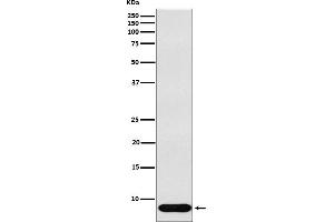 Western blot analysis of beta Defensin 1 expression in Human recombinant beta Defensin 1 lysate.