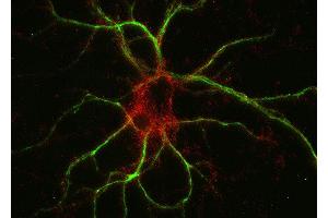 Indirect immunostaining of PFA fixed rat hippocampus neurons with anti-M6a glycoprotein (dilution 1 : 500; red) and mouse anti-MAP 2 (cat.