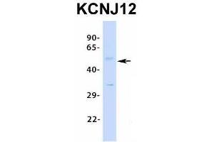 Host:  Rabbit  Target Name:  KCNJ12  Sample Type:  Human Fetal Pancreas  Antibody Dilution:  1.