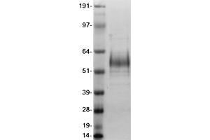 Validation with Western Blot (IL1RL1 Protein (Transcript Variant 2) (DYKDDDDK-His Tag))