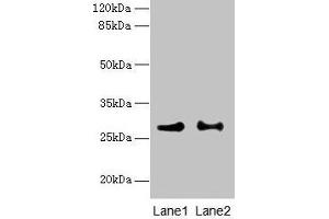 Western blot All lanes: HACD2 antibody at 4 μg/mL Lane 1: MCF-7 whole cell lysate Lane 2: LO2 whole cell lysate Secondary Goat polyclonal to rabbit IgG at 1/10000 dilution Predicted band size: 29 kDa Observed band size: 29 kDa (PTPLB anticorps  (AA 7-41))