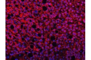 IF analysis of TMPRSS13 using anti-TMPRSS13 antibody (ABIN7599797). (TMPRSS13 anticorps  (AA 118-572))