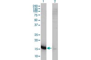 Western Blot analysis of CMTM5 expression in transfected 293T cell line by CKLFSF5 monoclonal antibody (M01), clone 2G1-6B10.