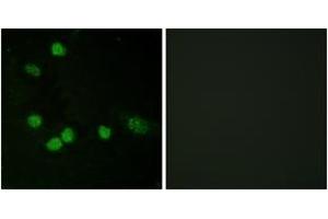 Immunofluorescence analysis of HeLa cells, using C-RAF (Ab-621) Antibody. (RAF1 anticorps  (AA 591-640))