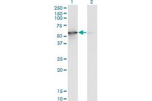 Western Blot analysis of STK25 expression in transfected 293T cell line by STK25 monoclonal antibody (M02), clone 4B10. (STK25 anticorps  (AA 321-426))