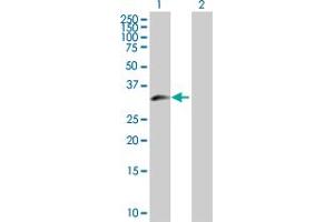 Western Blot analysis of ZNF215 expression in transfected 293T cell line by ZNF215 MaxPab polyclonal antibody. (ZNF215 anticorps  (AA 1-304))