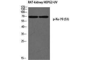 Western Blot (WB) analysis of Rat Kidney HepG2-UV using p-Ku-70 (S5) antibody.