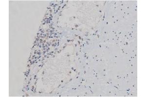 ABIN6267437 at 1/200 staining Human esophagus tissue sections by IHC-P.