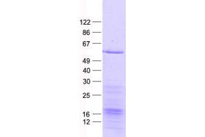 Validation with Western Blot