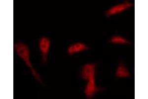 anti-Amyloid beta (A4) Precursor Protein (APP) (pThr668) antibody