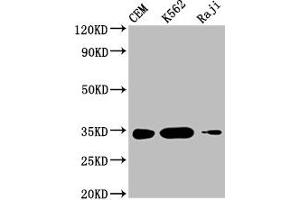 Western Blot Positive WB detected in: CEM whole cell lysate, K562 whole cell lysate, Raji whole cell lysate All lanes: CTLA4 antibody at 1:1000 Secondary Goat polyclonal to mouse IgG at 1/50000 dilution Predicted band size: 25, 7, 9, 20 KDa Observed band size: 34 KDa Exposure time:5 min (CTLA4 anticorps  (AA 37-162))