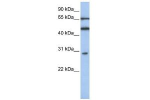 IFIT5 antibody used at 1 ug/ml to detect target protein. (IFIT5 anticorps  (N-Term))