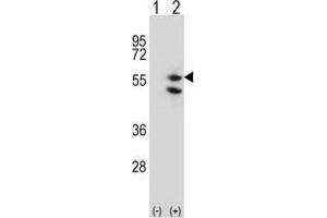 Western blot analysis of TUFM (arrow) using rabbit polyclonal TUFM Antibody (C-term) . (TUFM anticorps  (C-Term))