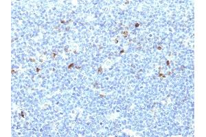 Formalin-fixed, paraffin-embedded human Tonsil stained with MHC I Monoclonal Antibody (CATA-1). (HLA-A anticorps)