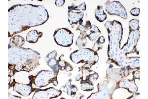 IHC analysis of TFPI2 using anti- TFPI2 antibody .