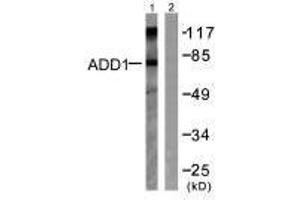 Western blot analysis of extracts from Hela cells treated with Forskolin (40nM, 30 min), using ADD1 (Ab-726) antibody. (alpha Adducin anticorps  (Ser726))