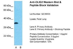 Host: Rabbit  Target Name: OLIG2  Sample Tissue: Fetal LungLane A:  Primary Antibody Lane B:  Primary Antibody + Blocking Peptide Primary Antibody Concentration: 1 µg/mL Peptide Concentration: 5 µg/mL Lysate Quantity: 41 µg/laneGel Concentration:. (OLIG2 anticorps  (C-Term))