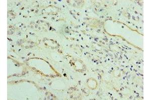 Immunohistochemistry of paraffin-embedded human kidney tissue using ABIN7143802 at dilution of 1:100 (ST8SIA2 anticorps  (AA 24-160))