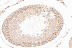Immunohistochemistry analysis of paraffin-embedded rat testis using,NCKAP1 (ABIN7074784) at dilution of 1: 8000 (NCKAP1 anticorps)