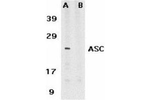 Western blot analysis of ASC in HL60 whole cell lysate in the absence (A) or presence (B) of blocking peptide with AP30084PU-N ASC antibody at 1 μg /ml.