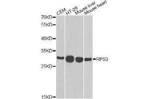 Western blot analysis of extracts of various cell lines, using RPS3 antibody (ABIN6290898) at 1:1000 dilution. (RPS3 anticorps)