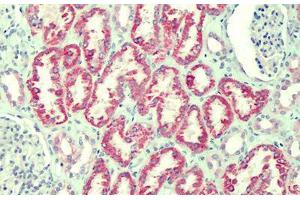 Human Kidney: Formalin-Fixed, Paraffin-Embedded (FFPE) (ANTXR2 anticorps  (AA 121-133))