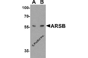 Western Blotting (WB) image for anti-Arylsulfatase B (ARSB) (C-Term) antibody (ABIN2457880) (Arylsulfatase B anticorps  (C-Term))