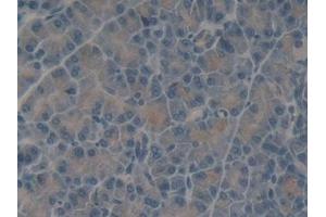 Detection of TLN1 in Rat Pancreas Tissue using Polyclonal Antibody to Talin 1 (TLN1)