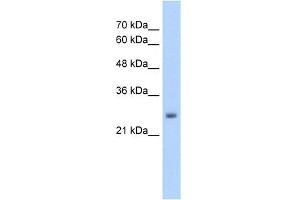 WB Suggested Anti-NELF Antibody Titration:  5. (NMDA Receptor Synaptonuclear Signaling and Neuronal Migration Factor (NSMF) (Middle Region) anticorps)