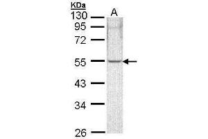 WB Image Sample (30 ug of whole cell lysate) A: A431 , 10% SDS PAGE antibody diluted at 1:1000 (ARHGAP1 anticorps)