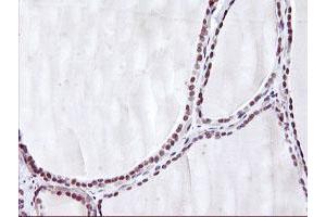 Immunohistochemical staining of paraffin-embedded Human thyroid tissue using anti-HES1 mouse monoclonal antibody. (HES1 anticorps)