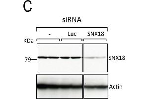 SNX9 depletion phenocopies CHC depletion during mitosis. (SNX18 anticorps  (C-Term))