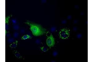 Image no. 6 for anti-Pantothenate Kinase 2 (PANK2) antibody (ABIN1500026)