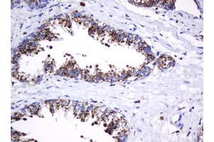 Image no. 12 for anti-Galactosidase, beta 1 (GLB1) antibody (ABIN1498467)