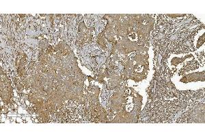 IHC analysis of PLTP using anti-PLTP antibody (ABIN7600346). (PLTP anticorps  (AA 18-470))