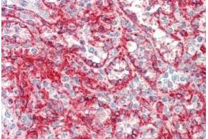 Human Spleen: Formalin-Fixed, Paraffin-Embedded (FFPE)