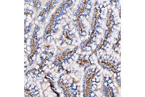 IHC analysis of Col6a2 using anti-Col6a2 antibody (ABIN7602398).