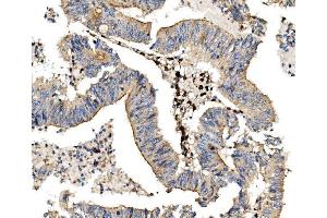 IHC analysis of LPP using anti LPP antibody (ABIN7602831).