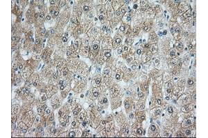 Immunohistochemical staining of paraffin-embedded Human prostate tissue using anti-RAB17 mouse monoclonal antibody. (RAB17 anticorps)