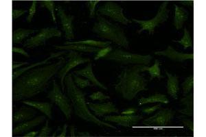Immunofluorescence of monoclonal antibody to ERCC2 on HeLa cell.