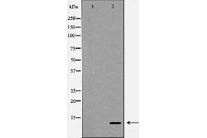 Western blot analysis of SDF 1 expression in HepG2 cells,The lane on the left is treated with the antigen-specific peptide. (CXCL12 anticorps  (C-Term))