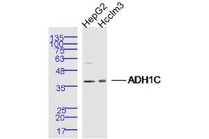 Lane 1: Hepg2 lysates Lane 2: Hcclm3 lysates probed with ADH1C Polyclonal Antibody, Unconjugated  at 1:300 dilution and 4˚C overnight incubation.