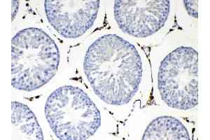 IHC analysis of NSF using anti-NSF antibody .